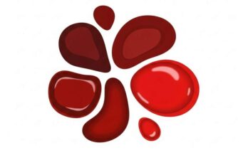 혈액암, 신호를 놓치면 큰일나요! 이 5가지 증상 꼭 확인해보세요.